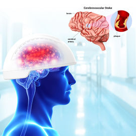 Traumatische van de Hersenenphotobiomodulation van de Hersenenverwonding de Apparaten810nm Golflengte