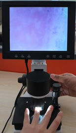 Kleurennailfold Capillaire Microscoop 380000 van het Microcirculatiemateriaal pixel met Ce
