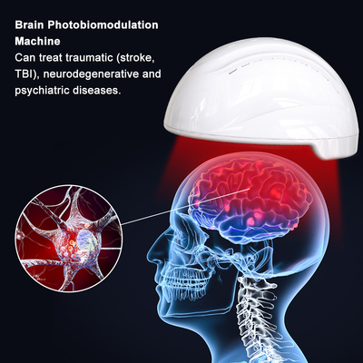 Lichttherapie Fotobiomodulatie Helm voor traumatische gebeurtenissen (beroerte, traumatisch hersenletsel en wereldwijde ischemie)